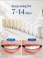 Pro LED Whitening Kit – 10 Min Results