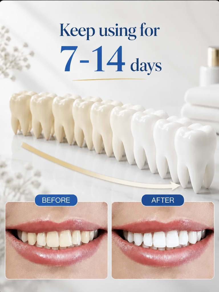 Pro LED Whitening Kit – 10 Min Results